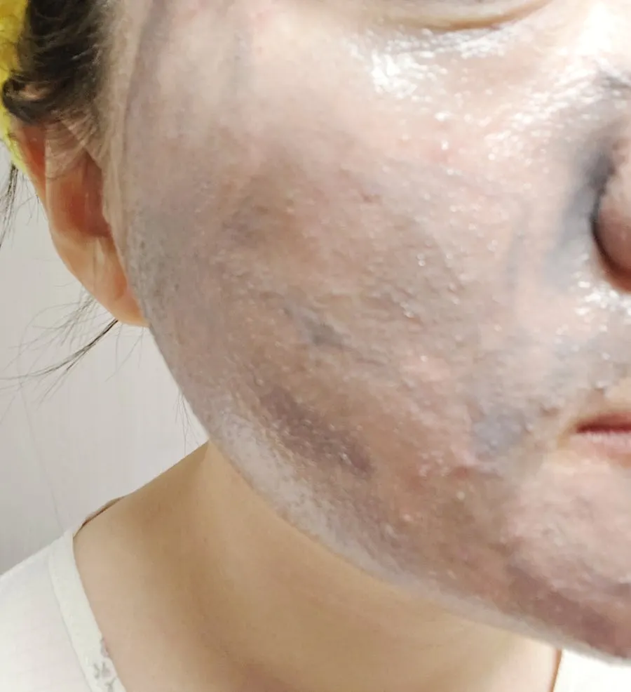 Cleansing balm for oily sensitive skin: HEEDA Jirisan Moist Charcoal
