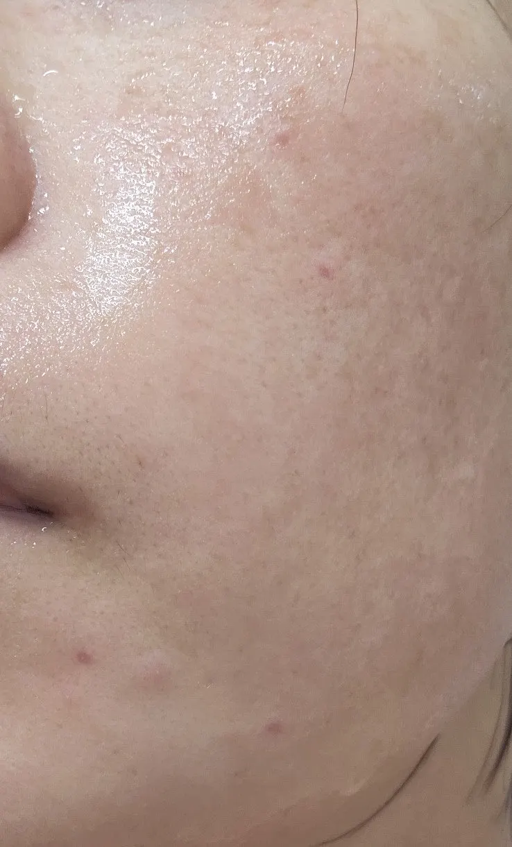 건성 피부 클렌징밤 겨울 세안 후 당김 관찰, 희다 지리산 촉촉 숯 클렌징밤