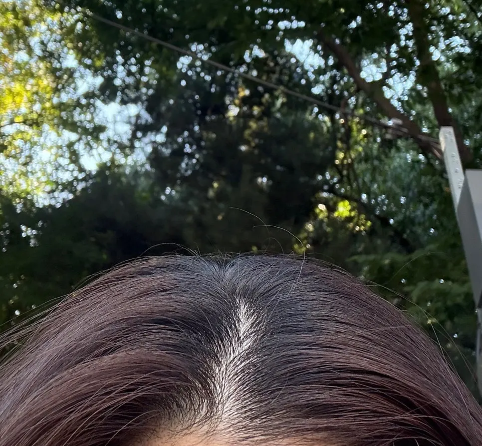 Wavy, grown-out crown area before treatment
