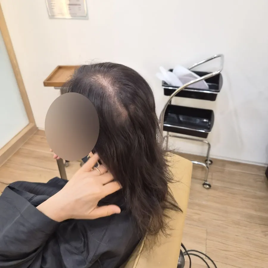 Deciding on the bob length during consultation