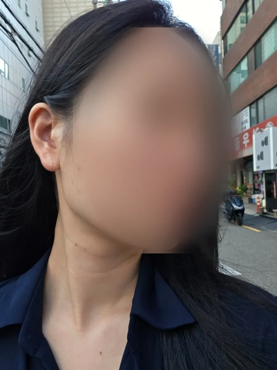 Base makeup being applied on acne-prone, oily skin