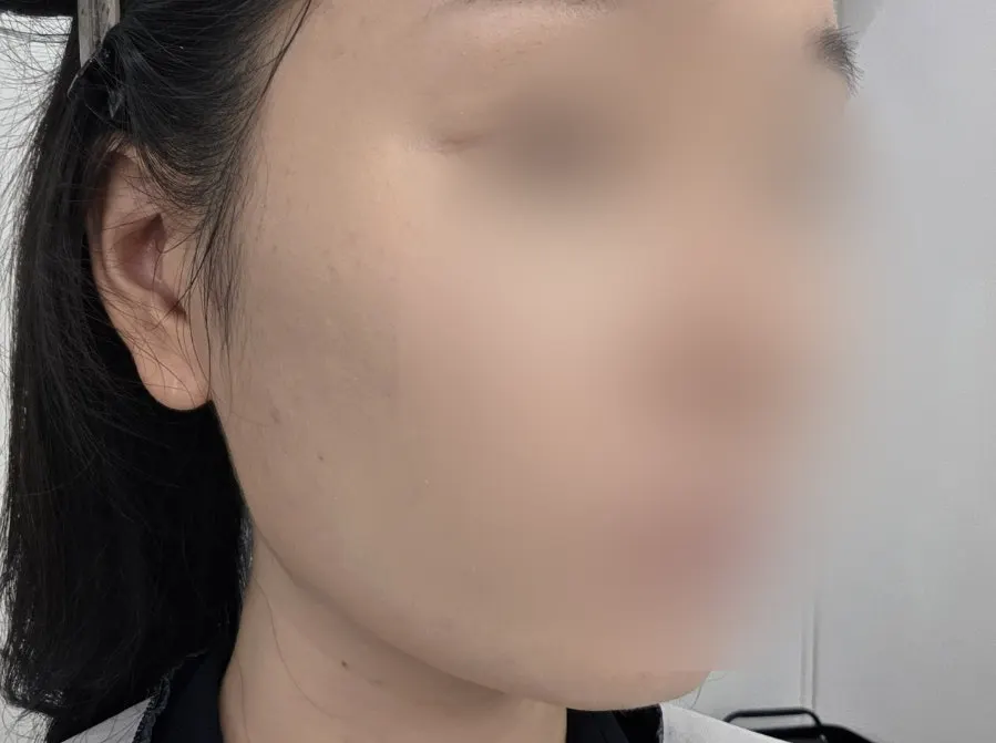 Skin after the first round of base makeup