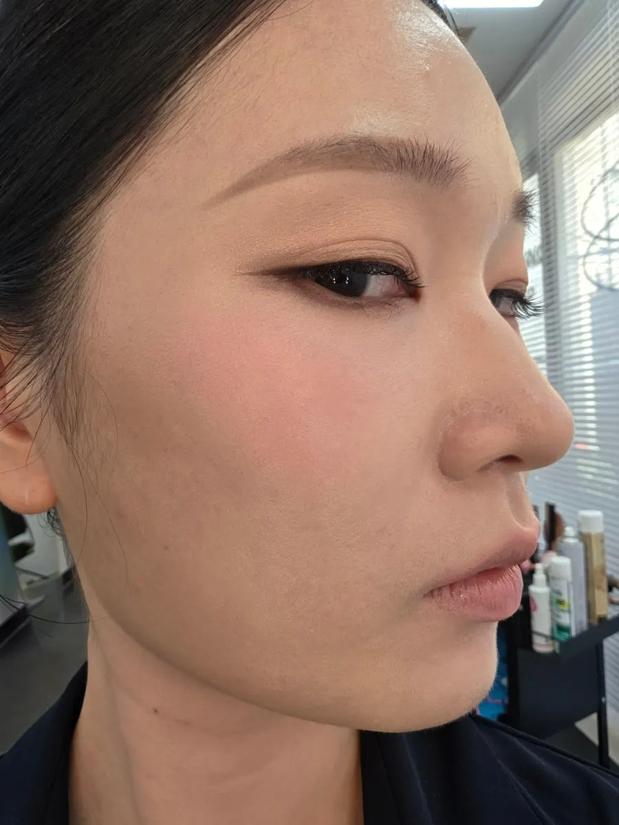 Skin with acne marks covered using pot concealer