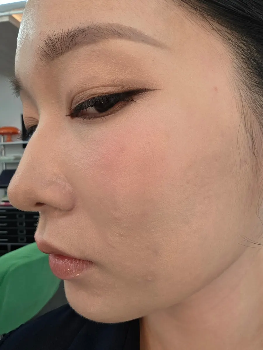 Result of the thin, layered concealer coverage