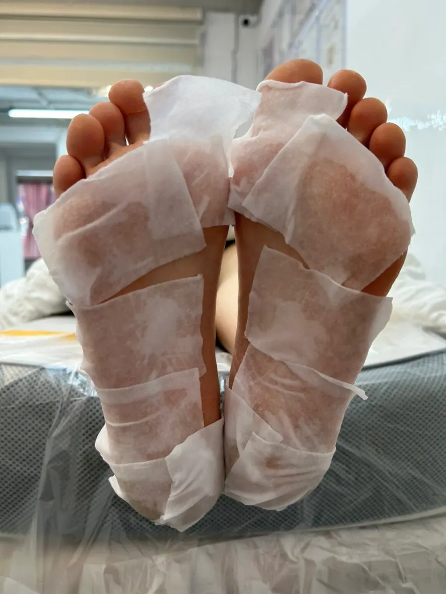 발에 각질 연화 약품을 바른 상태