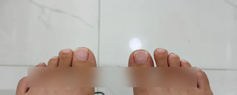 Magnetic-nail pedicure after gel removal