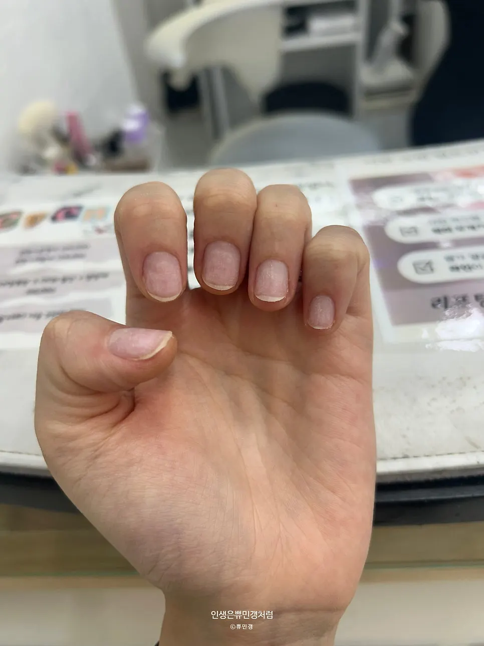 시술 전 깨진 손톱 클로즈업