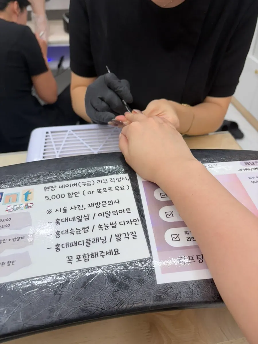 시술 전 맨손톱 상태