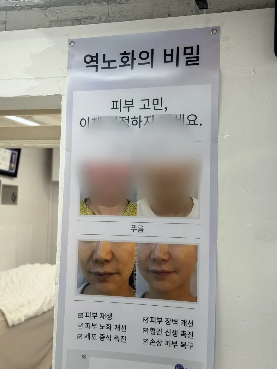 피부 관리 홍보물과 판매 화장품 진열