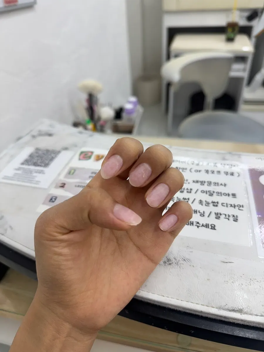 아세톤 최소화로 깔끔하게 제거된 손톱