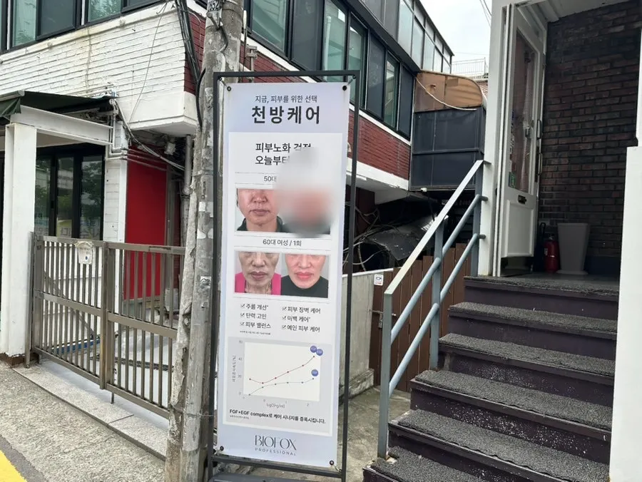 뷰아즈 시술 항목이 적힌 매장 외부 안내
