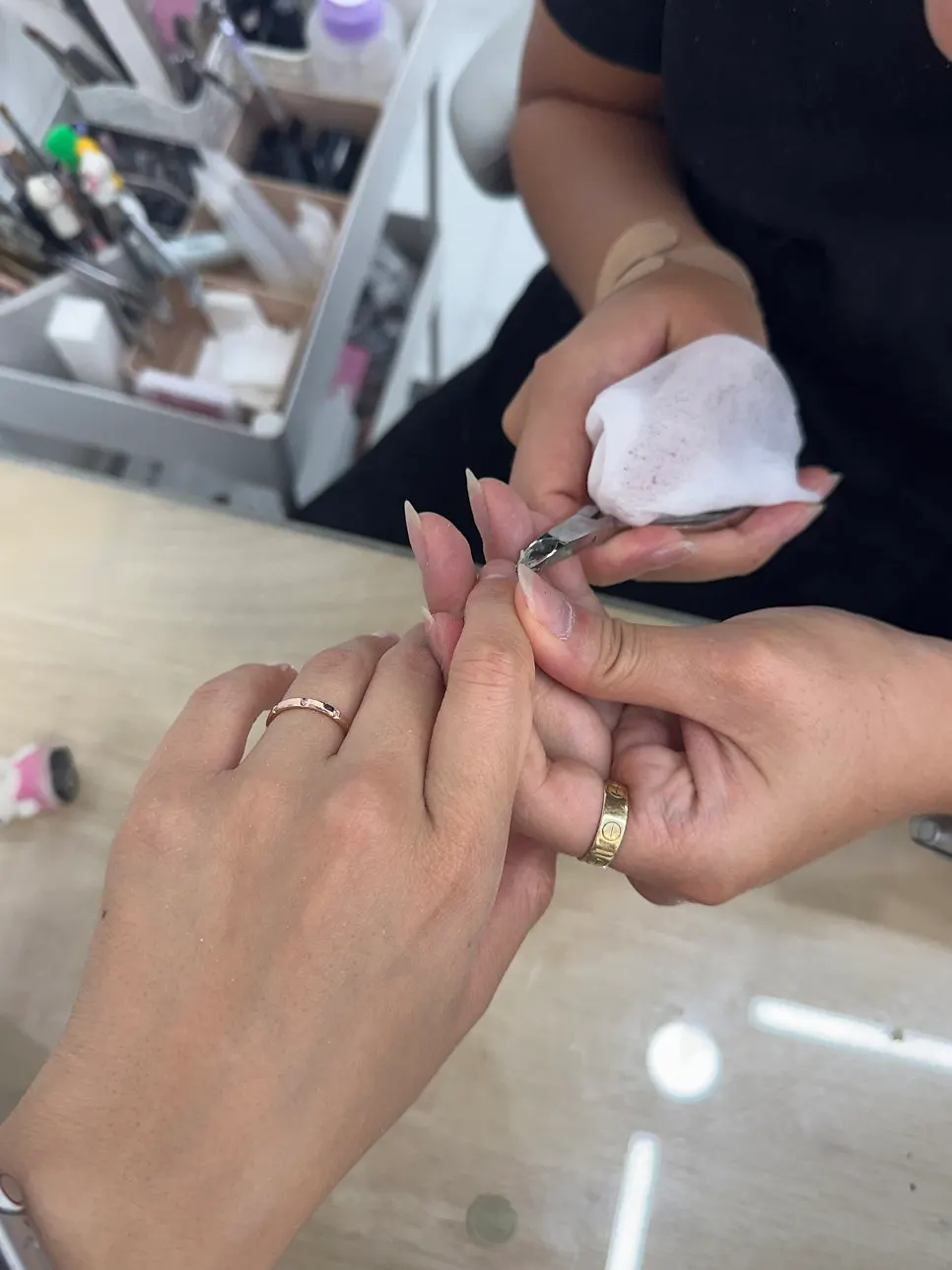 시술 전 손톱 상태