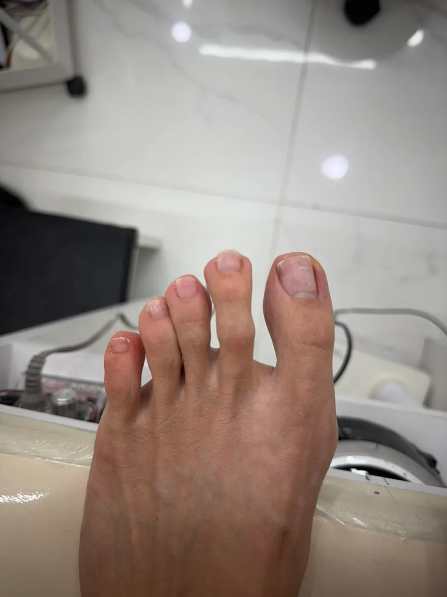 Feet being prepped for treatment after the foot soak