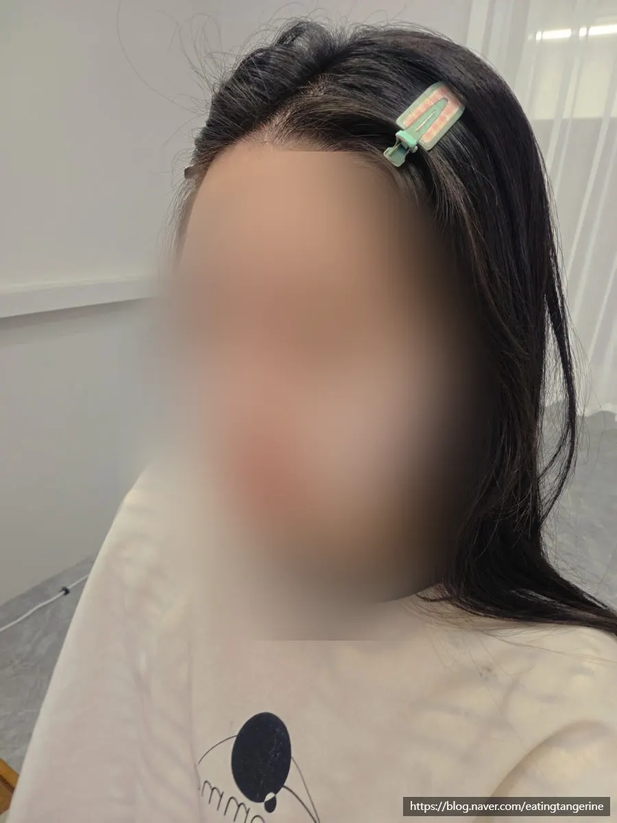 Selfie after the toner pack, wearing colored lenses