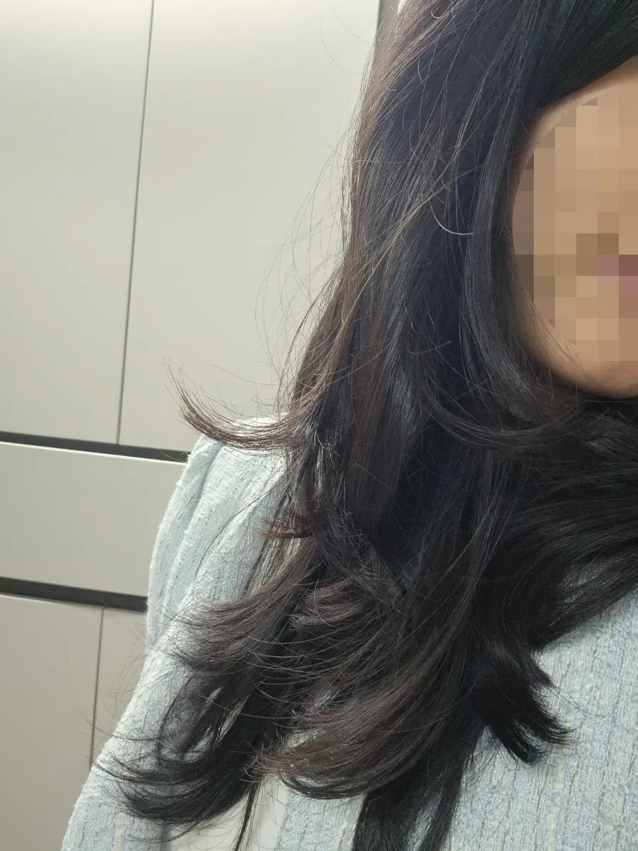 시술 전과 시술 3일 후 비교 모습