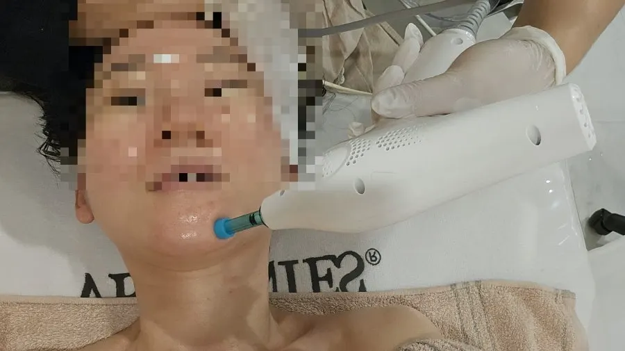 Device used for face-line care