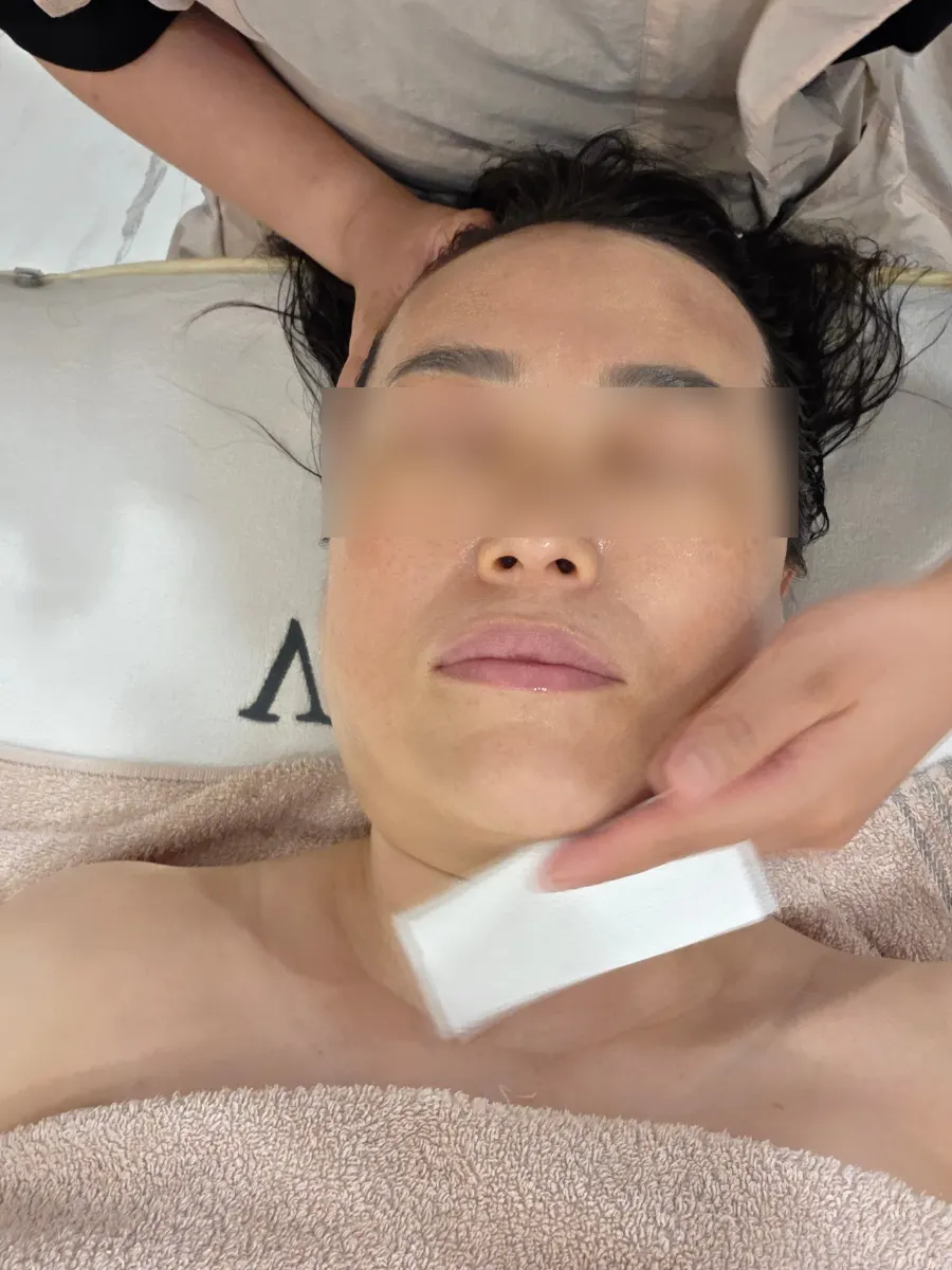 Refined skin texture after a cooling mask