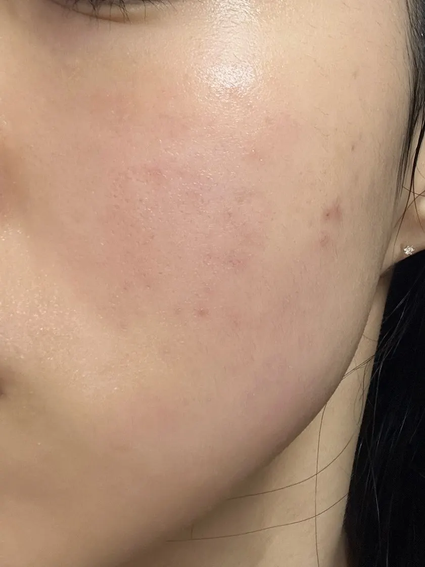 Moisturizing cream used with oil in winter