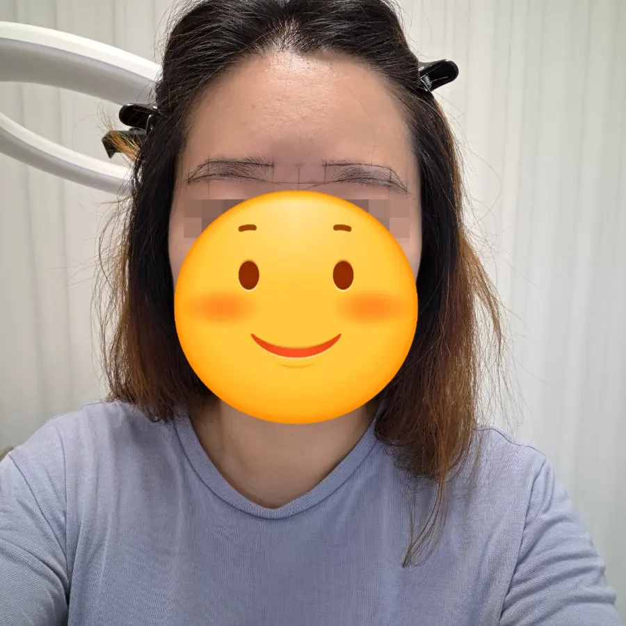 눈썹 시술 통증 체감 관련 사진