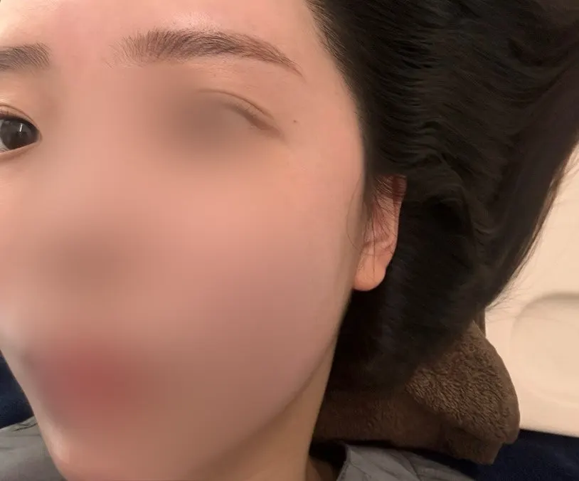 바이오포톤 기구에 누워 받는 온열 관리