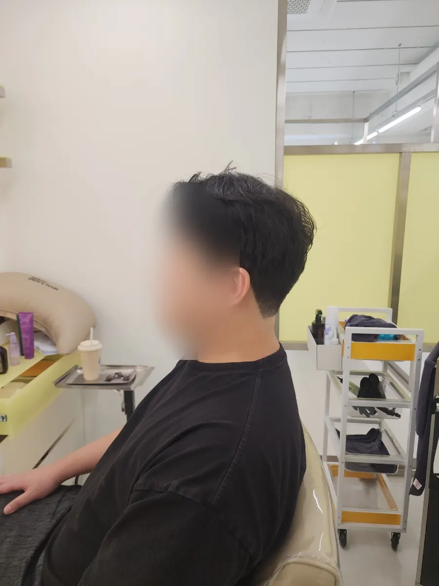 サイドのボリューム調整が必要な施術前の髪