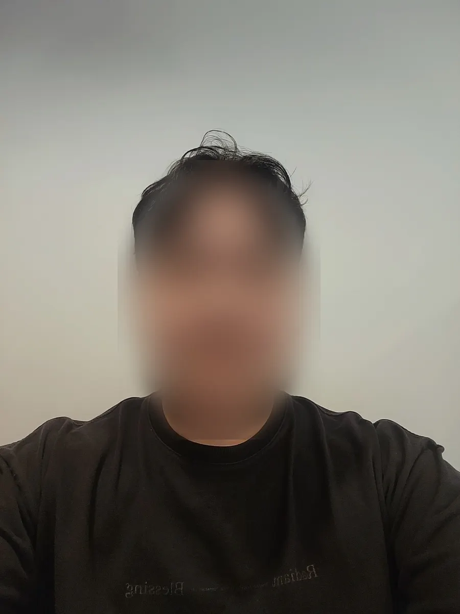 イウム・メンズヘアで受けたサイドのダウンパーム施術