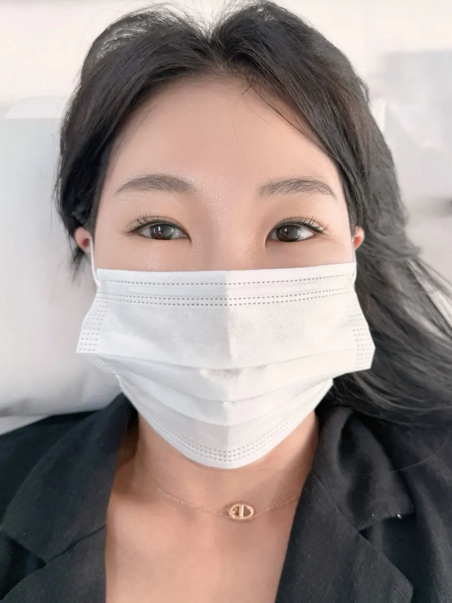 애교살반영구 직후 눈매 변화