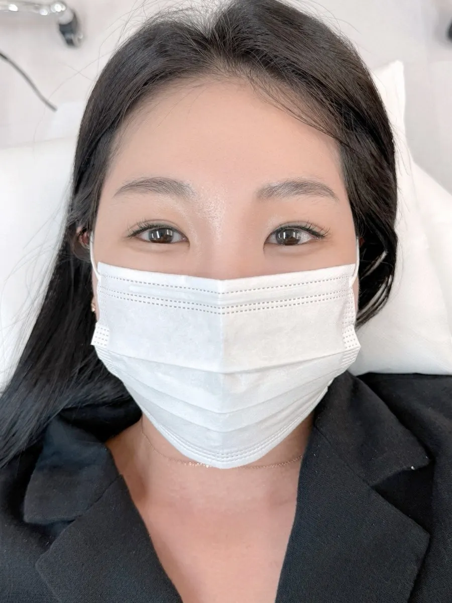 애교살반영구 후 또렷해진 눈매