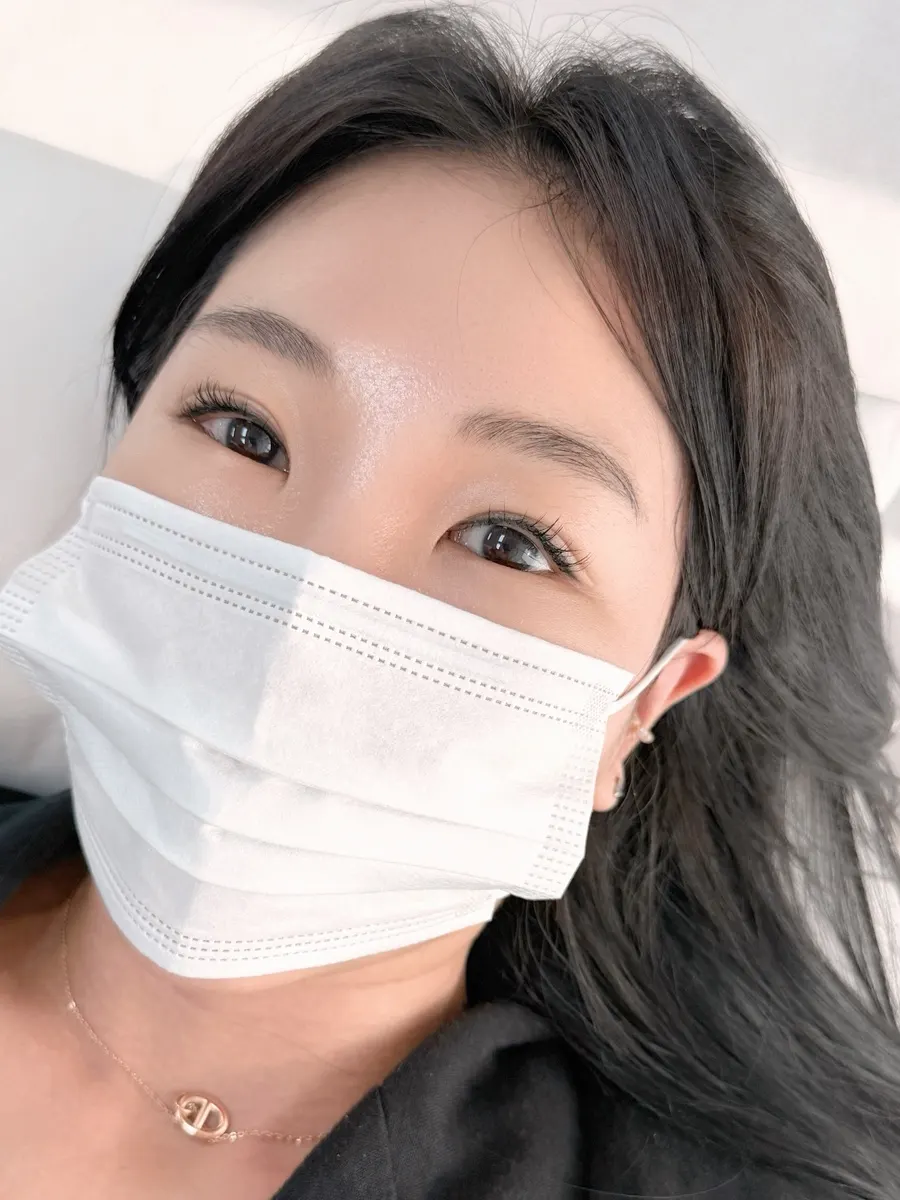 애교살반영구 시술 전 눈매