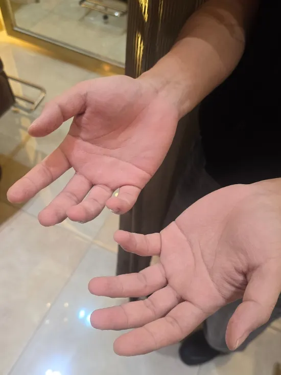 The director's hands after finishing the treatment