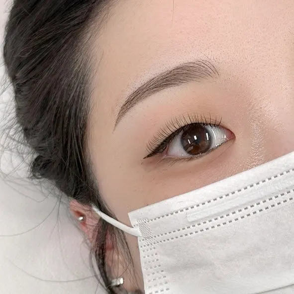 Photo showing the use of sterile disposable needles