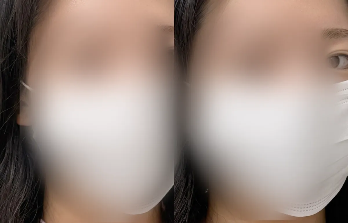 Before and after comparison of the combo eyebrow tattoo