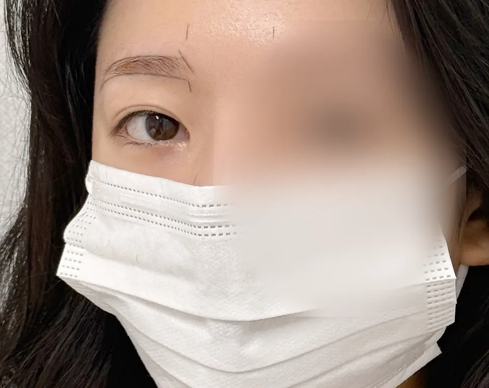 Tools and process used during the eyebrow tattoo procedure