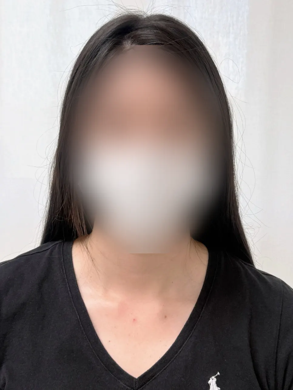 Before photo showing the remaining marks on the eyebrows