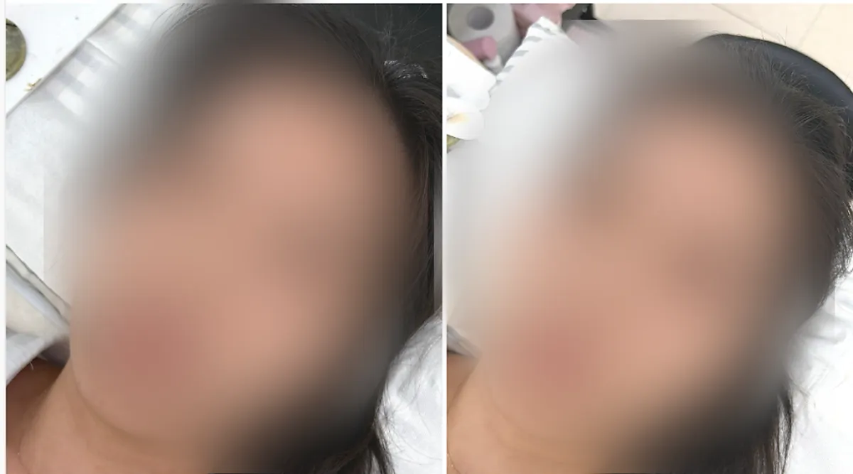 Before and after comparison of flat-lash eyelash extensions