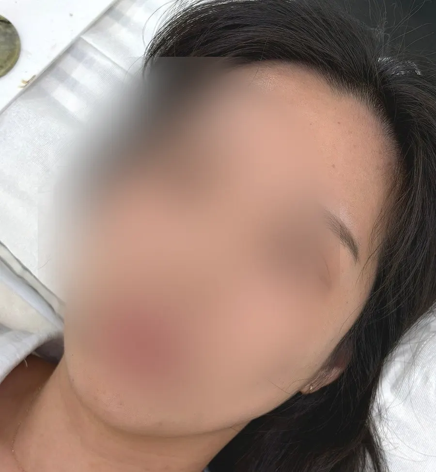 Flat, sparse lashes before extensions