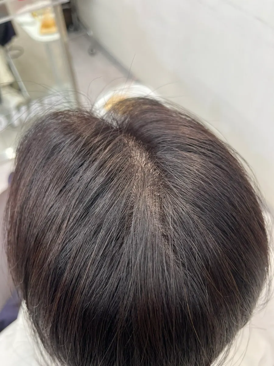 마드헤어 뿌리염색과 클리닉 방문