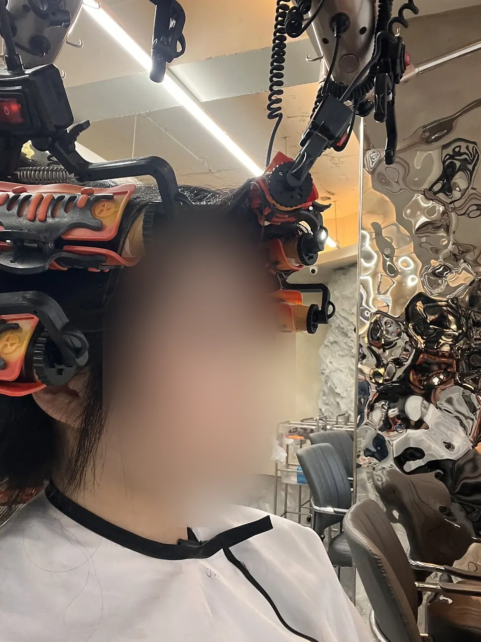 구역별로 나눠 진행하는 빌드펌 시술