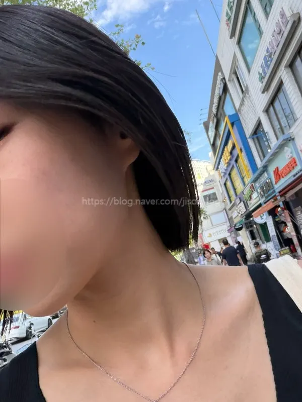 시술 전 단발 모발 상태