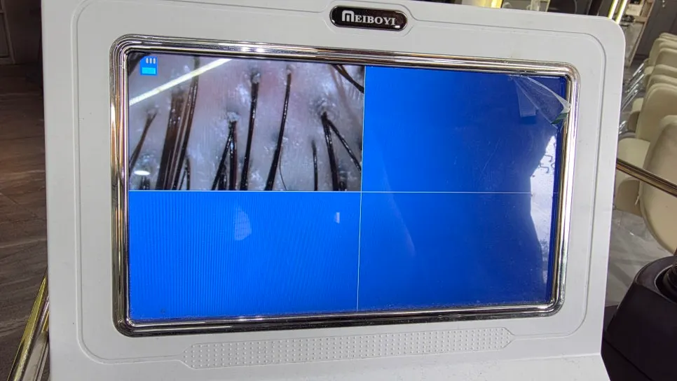 Checking scalp condition with a camera-type device