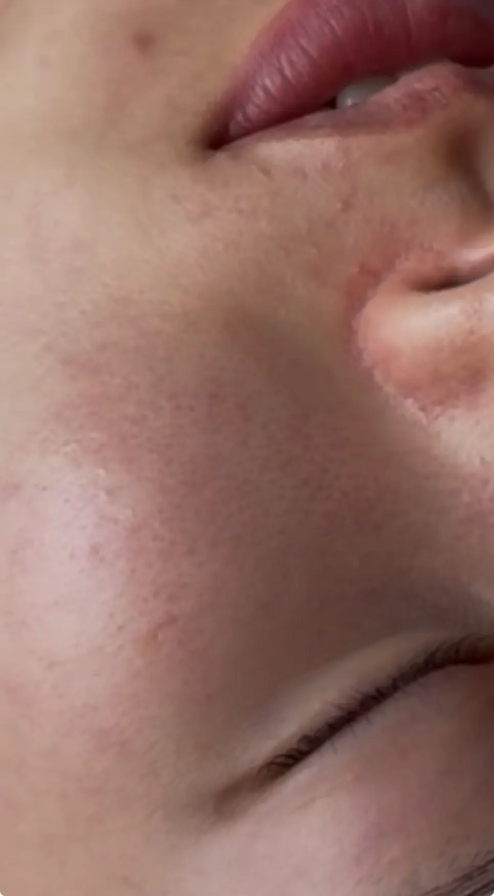 Skin condition with trouble and redness