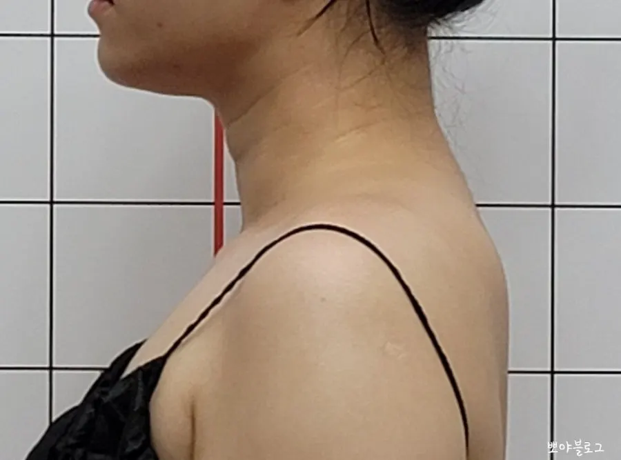 겨드랑이까지 연결해 관리하는 장면