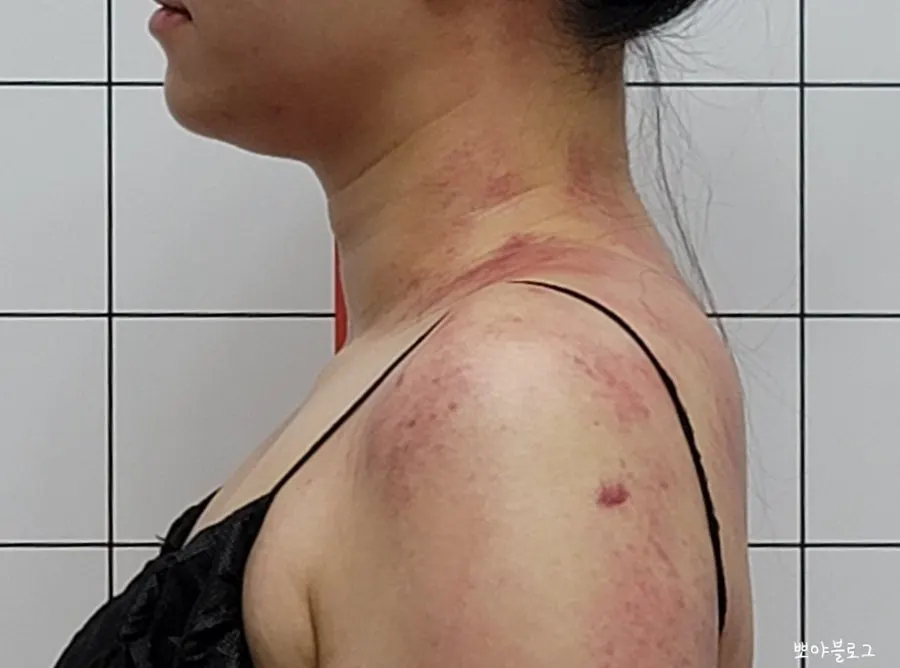 어깨 주변을 꼼꼼히 풀어주는 손