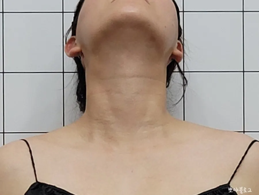 전신관리 마무리 단계 모습