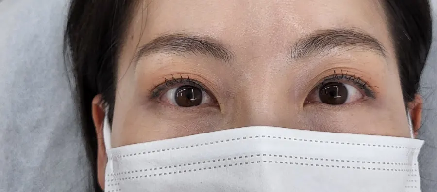 Drooping lashes before the lash lift treatment