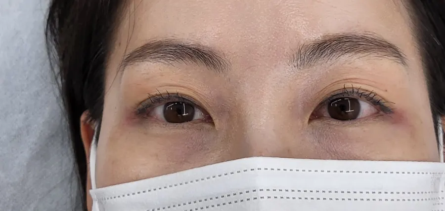 Short, uncurled lashes before treatment