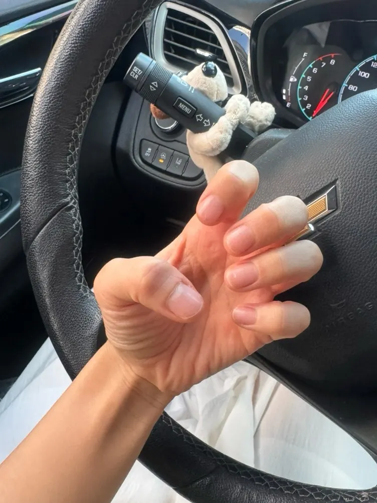Short nails before the treatment
