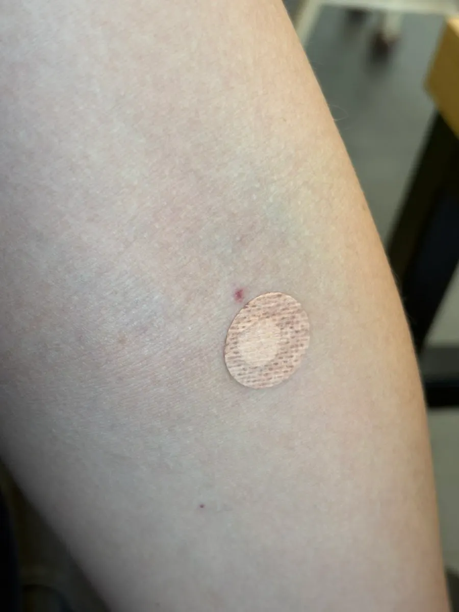 Bandage placed in a different spot from where blood was drawn during the health checkup
