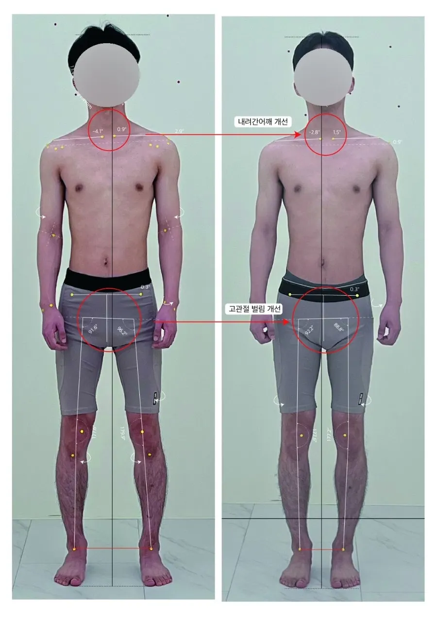조셉테라핏 비포·애프터 체형분석 자료