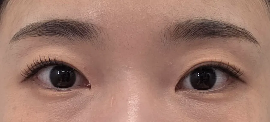 Finished eye look with lash extensions placed under the mucosa